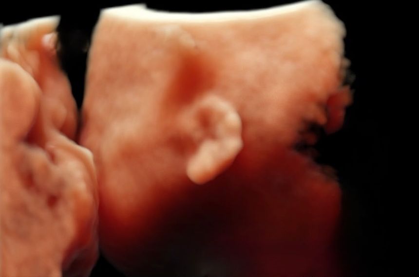 3 boyutlu ultrasonografide fetal kulak ve yüz detayı