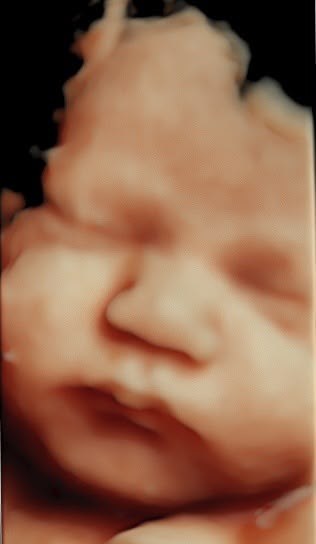 3 boyutlu ultrasonografi ile yakın plan fetal yüz görüntüsü