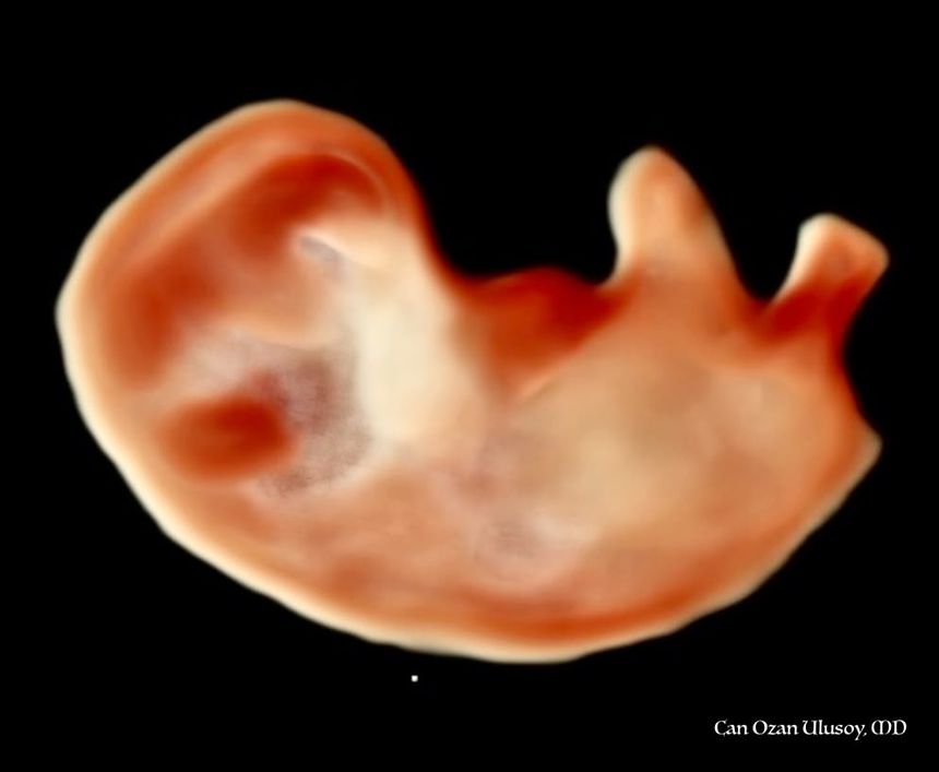 İlk trimesterde 3 boyutlu ultrasonografi ile görüntülenen erken gebelik (embriyo)