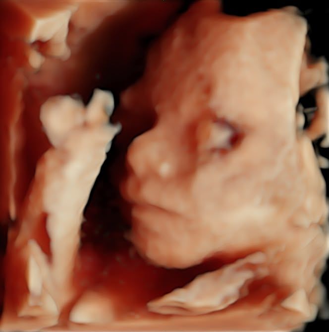 3 boyutlu ultrasonografide fetal yüz profili