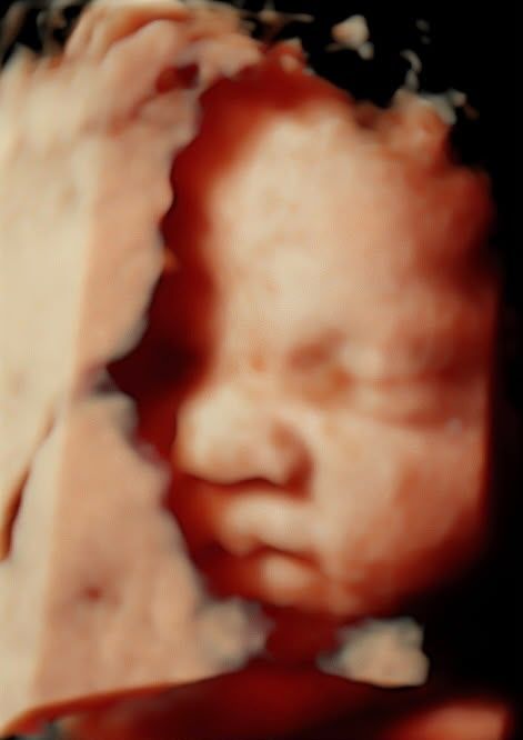 3 boyutlu ultrasonografi ile elde edilen fetal yüz görüntüsü